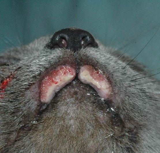 eosinophiler Granulomkomplex