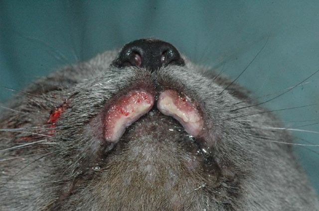eosinophiler Granulomkomplex
